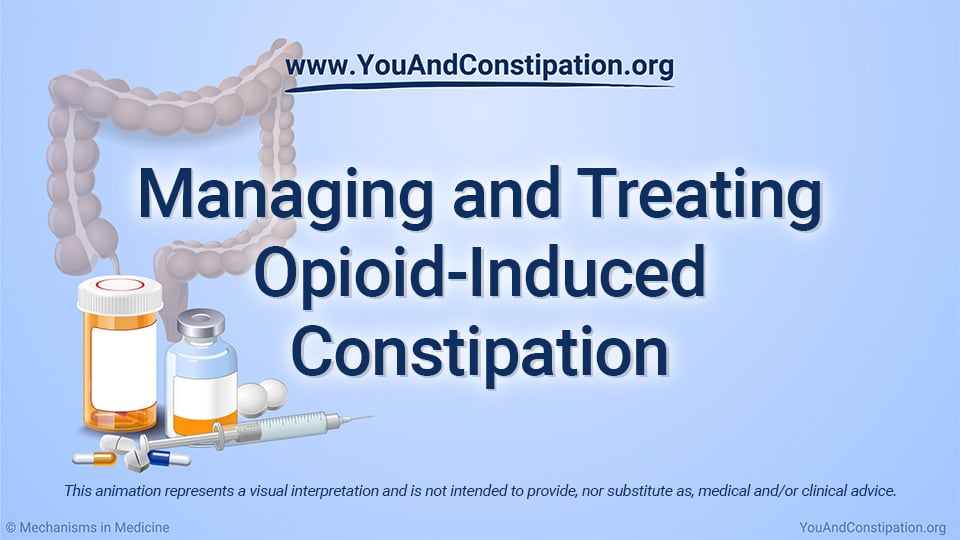 Opioid Induced Constipation (OIC) - About Constipation