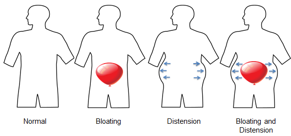 Upper/mid belly bloat? : r/chronicbloating