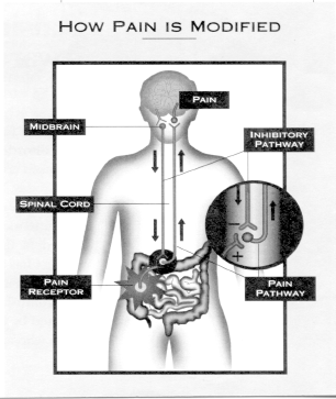 What is Abdominal Pain?